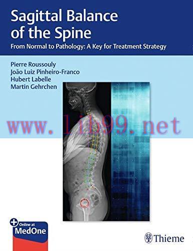 [AME]Sagittal Balance of the Spine: From_ Normal to Pathology: A Key for Treatment Strategy (PD...