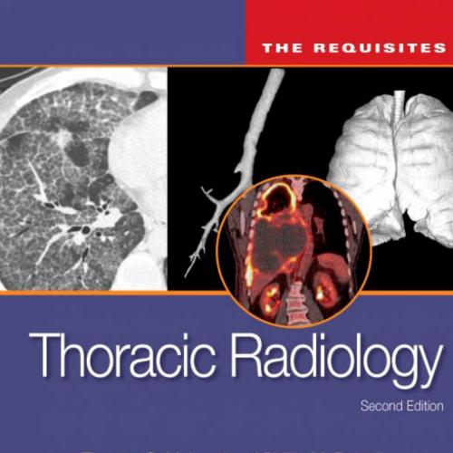 Thoracic Radiology_ The Requisites, Second Edition