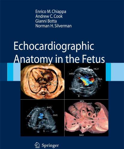 Echocardiographic Anatomy in the Fetus