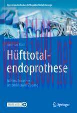 [PDF]H&uuml;fttotalendoprothese: minimalinvasiver anterolateraler Zugang