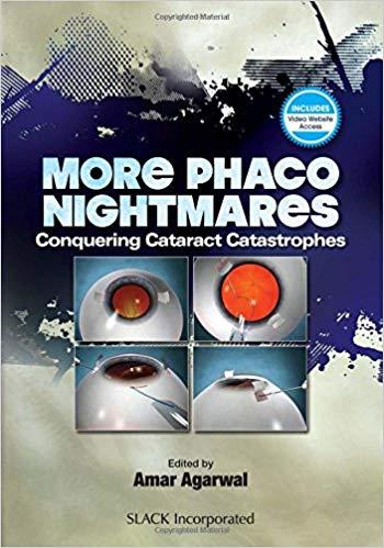 More Phacoo Nightmares