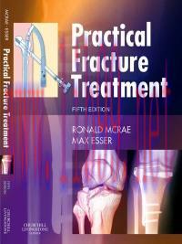[AME]Practical Fracture Treatment, 5e (Original PDF)
