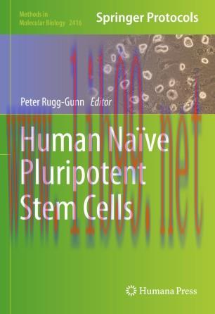 Human Naïve Pluripotent Stem Cells