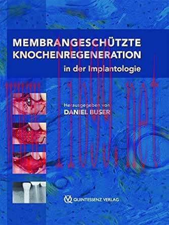 [AME]Membrangesch&uuml;tzte Knochenregeneration in der Implantologie (German Edition) (EPUB)