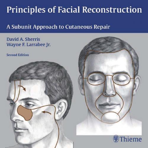 Principles of Facial Reconstruction-A Subunit Approach to Cutaneous Repair, 2nd Edition
