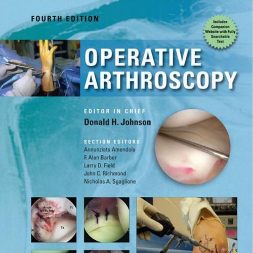 Operative Arthroscopy 4th Edition
