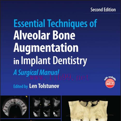 [AME]Essential Techniques of Alveolar Bone Augmentation in Implant Dentistry: A Surgical Manual...