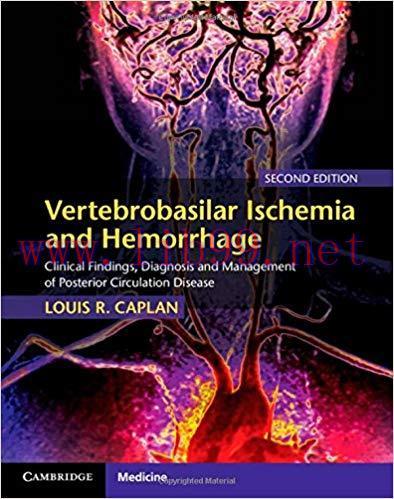 [PDF]Vertebrobasilar Ischemia and Hemorrhage, 2nd Edition