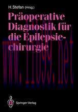 [PDF]Pr&auml;operative Diagnostik f&uuml;r die Epilepsiechirurgie