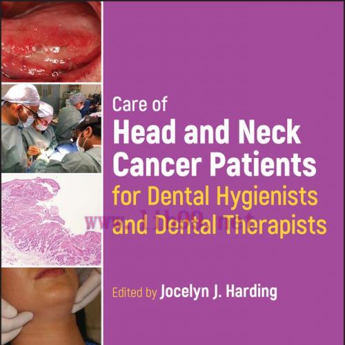 [AME]Care of Head and Neck Cancer Patients for Dental Hygienists and Dental Therapists (EPUB)
