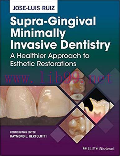 [PDF]Supra-Gingival Minimally Invasive Dentistry