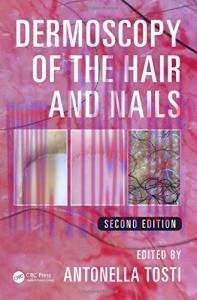[AME]Dermoscopy of the Hair and Nails, Second Edition