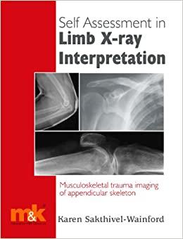 (PDF)Self Assessment in Limb X-ray Interpretation Musculoskeletal Trauma Imaging of Appendicula...