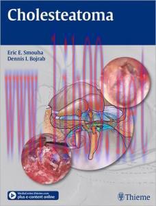 [AME]Cholesteatoma (Eirc E. Smouha)