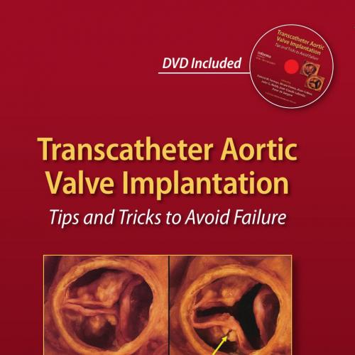 Transcatheter Aortic Valve Implantation-Tips and Tricks to Avoid Failure - Serruys, P. W_