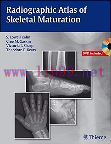 [PDF]Radiographic Atlas of Skeletal Maturation