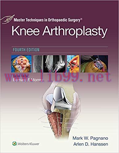 [PDF]Master Techniques in Orthopaedic Surgery: Knee Arthroplasty 4th Edition (PDF+EPUB+VIDEOS)
