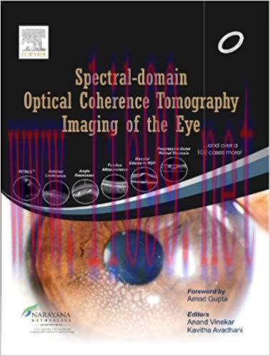 [PDF]Spectral-domain Optical Coherence Tomography Imaging of the Eye