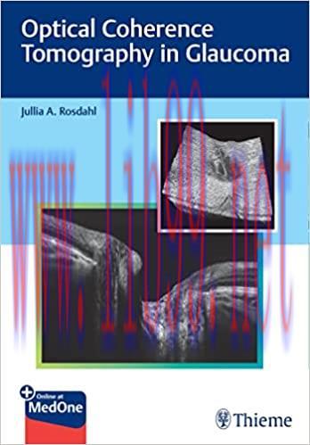 [PDF]Optical Coherence Tomography in Glaucoma