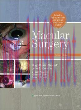 [AME]Macular Surgery, 2nd Edition (ORIGINAL PDF from_ Publisher)