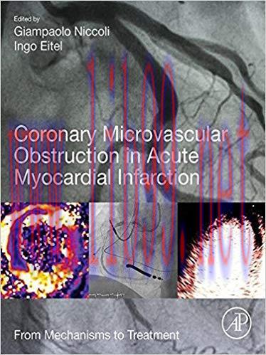 [PDF]Coronary Microvascular Obstruction in Acute Myocardial Infarction