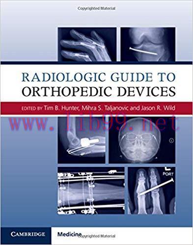 [PDF]Radiologic Guide to Orthopedic Devices