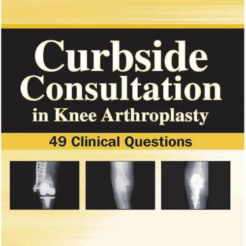Curbside Consultation in Knee Arthroplasty-49 Clinical Questions