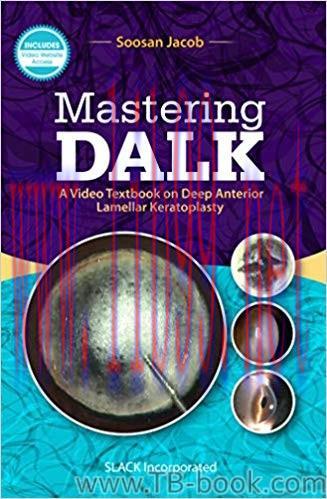 Mastering DALK: A Video Textbook on Deep Anterior Lamellar Keratoplasty 1st Edition by Soosan J...
