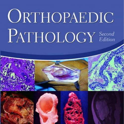 Orthopaedic Pathology 2nd Edition by Vincent J. Vigorita
