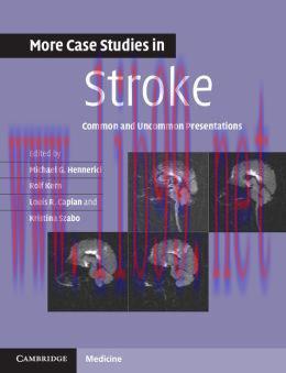 [AME]More Case Studies in Stroke: Common and Uncommon Presentations