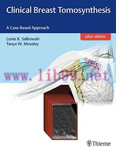 [AME]Clinical Breast Tomosynthesis: A Case-Based Approach (PDF)