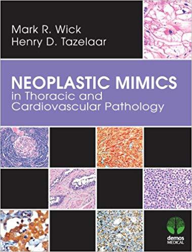 Neoplastic Mimics in Thoracic and Cardiovascular Pathology