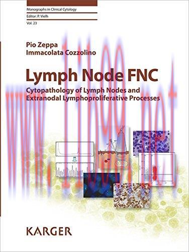 [AME]Lymph Node FNC: Cytopathology of Lymph Nodes and Extranodal Lymphoproliferative Processes ...