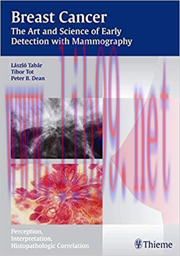 [PDF]Breast Cancer - The Art and Science of Early Detection with Mammography , 1e [Thieme] [200...