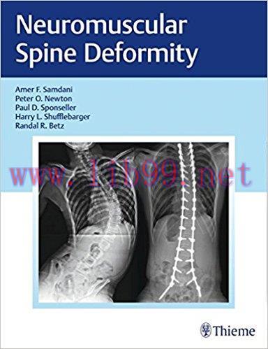 [AME]Neuromuscular Spine Deformity 1st Edition (Original PDF)