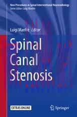[PDF]Spinal Canal Stenosis