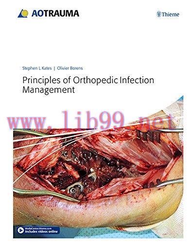 [AME]Principles of Orthopedic Infection Management (EPUB)