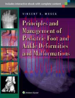 [AME]Principles and Management of Pediatric Foot and Ankle Deformities and Malformations (EPUB)