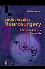 [PDF]Endovascular Neurosurgery: A Multidisciplinary Approach