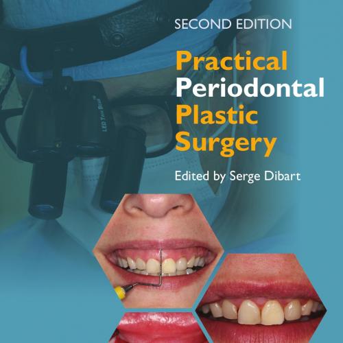 Practical Periodontal Plastic Surgery 2nd Edition