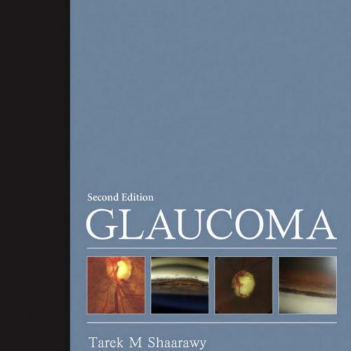 Glaucoma,2-Volume Set,2nd Edition