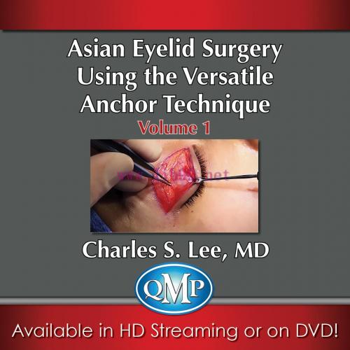 [AME]Asian Aesthetic Surgery Techniques, Volume 1: Asian Eyelid Surgery Using the Versatile Anc...