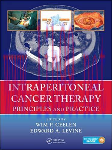 [PDF]Intraperitoneal Cancer Therapy - Principles and Practice