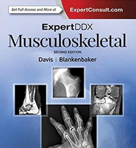 ExpertDDx Musculoskeletal Second Edition E-Book