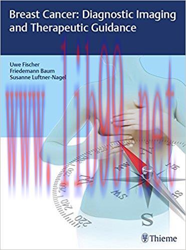 [AME]Breast Cancer: Diagnostic Imaging and Therapeutic Guidance (EPUB)
