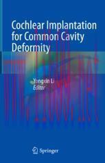 [PDF]Cochlear Implantation for Common Cavity Deformity