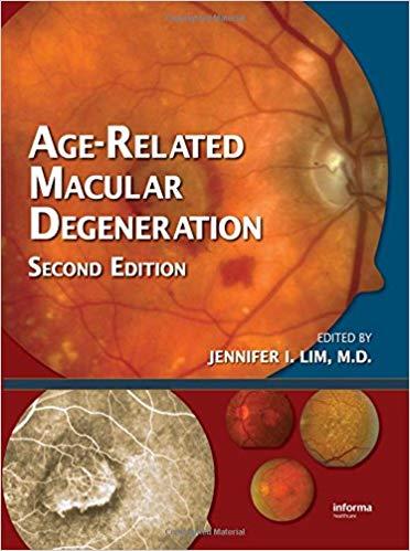 Age-Related Macular Degeneration, Second Edition [LWW]
