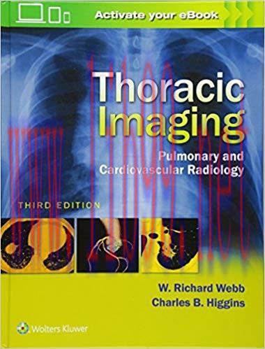 [CHM]Thoracic Imaging - Pulmonary and Cardiovascular Radiology, 3rd Edition