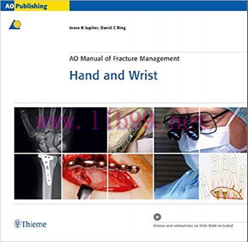 [PDF]AO Manual of Fracture Management - Hand and Wrist (包含视频)