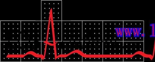[AME]ECGAcademy: Basic to Advanced Theory + Chalktalk Videos (up to December 2016)